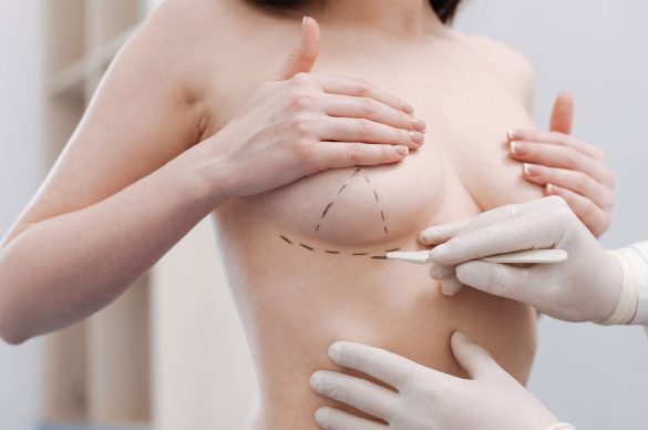 Breast Implant in Turkey Breast Implant in Turkey