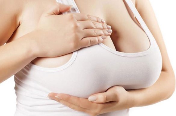Breast Reduction Aesthetics in Turkey
