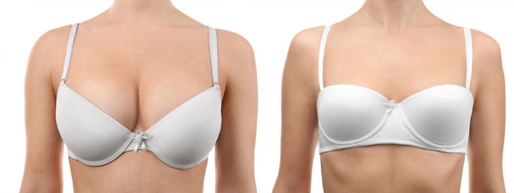 Breast Reduction Aesthetics in Turkey